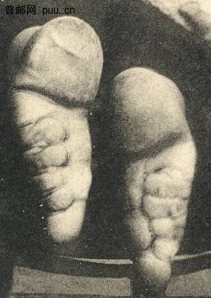 小腳女人的腳2.(局部).jpg